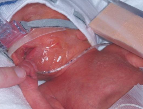 Comparing Nasal High-Flow Therapy to Nasal Continuous Positive Airway Pressure during Neonatal Transport